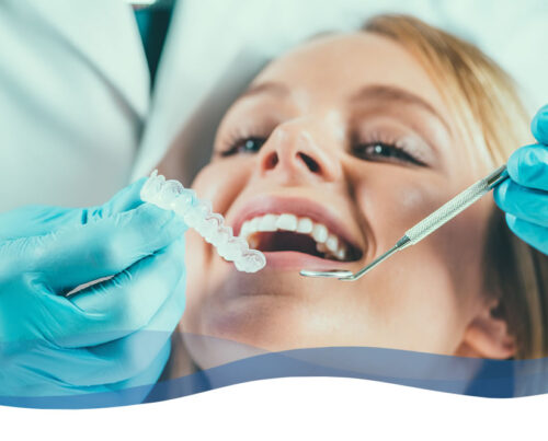 blanqueamiento-dental-clinica-dental-olmos